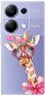iSaprio Lady Giraffe - Xiaomi Redmi Note 13 Pro - Phone Cover