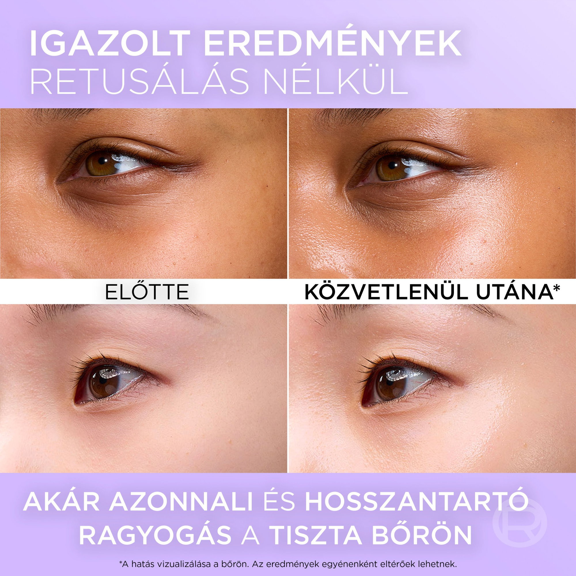 Arckrém L_ORÉAL PARIS Revitalift Filler Glass Skin 50 ml NameExt - érzékeny, zsíros, normál, problémás, vegyes, száraz és érett bőrre egyaránt alkalmas,