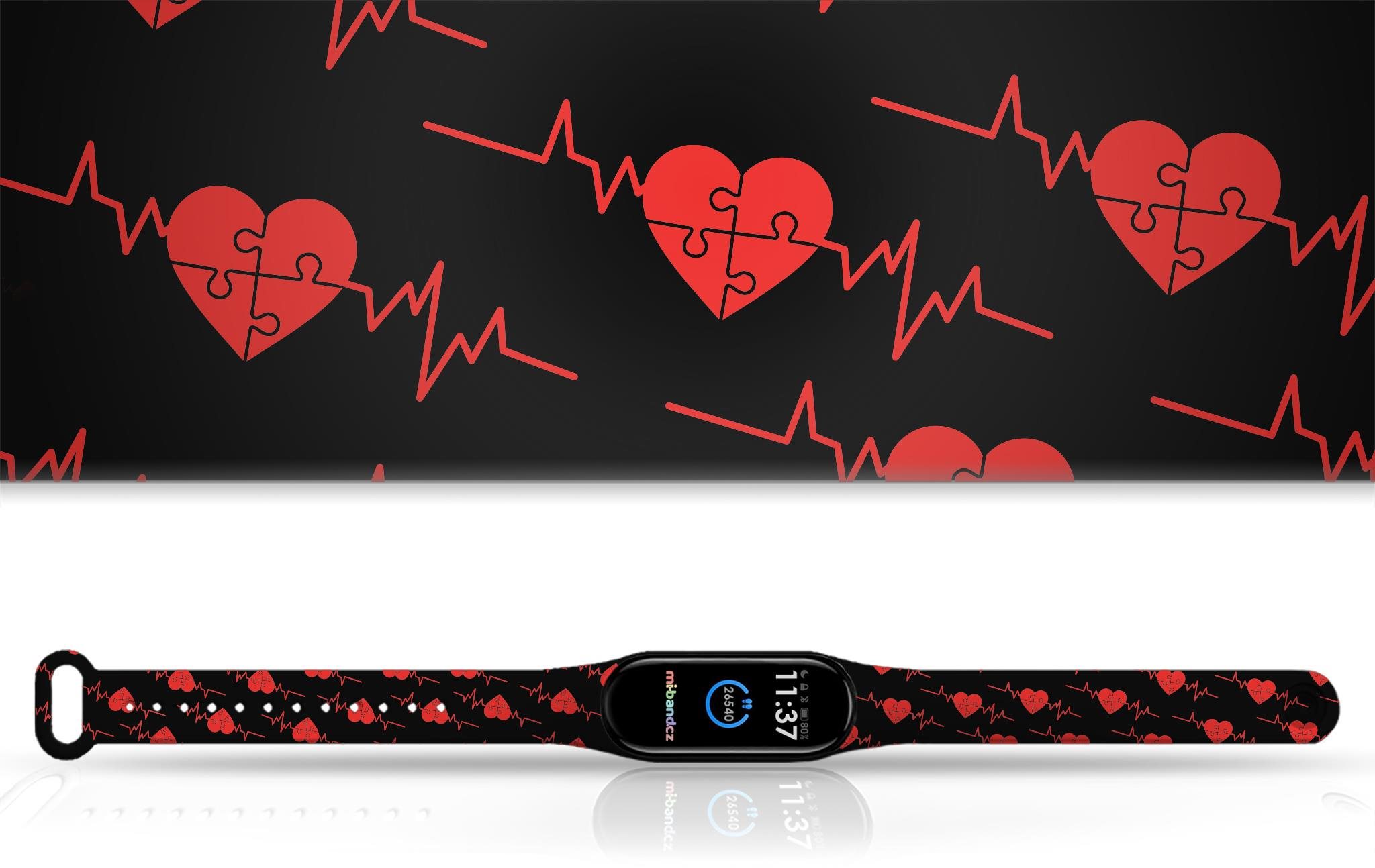 Ekg watch band hot sale