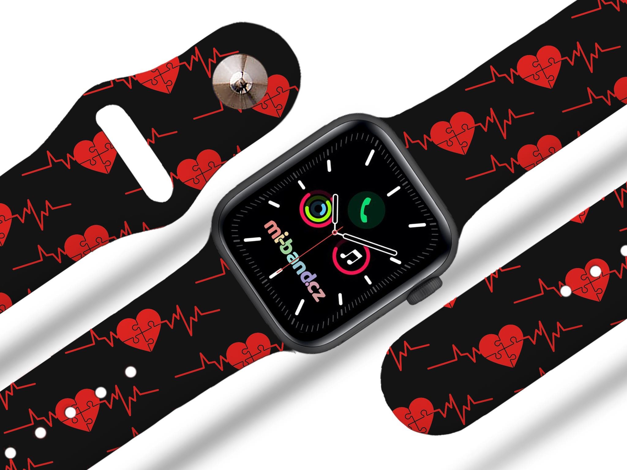 Ekg top watch band