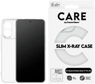 PanzerGlass CARE case for Xiaomi Redmi Note 17 Pro 5G X-Ray - Phone Cover