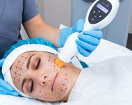 Neinvazivní účinný facelifting CPT Thermage 60 min (ošetření celého obličeje) v centru Plzně - Voucher: