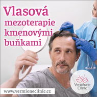 Poukaz na VLASOVOU MEZOTERAPII s kmenovými buňkami - 1x ošetření - Voucher: