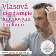 Poukaz na VLASOVOU MEZOTERAPII s kmenovými buňkami - 3x ošetření - Voucher: