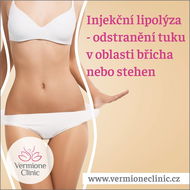 Poukaz na INJEKČNÍ LIPOLÝZU - odstranění tuku v oblasti břicha nebo stehen - 1 ošetření - Voucher: