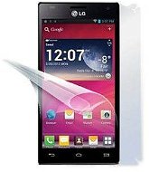 ScreenShield für LG Optimus 4X HD (P880) für das gesamte Telefon-Gehäuse - Schutzfolie