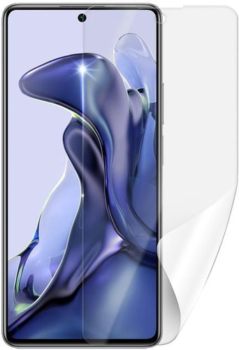 Screenshield XIAOMI 11T na displej - Ochranná fólie - Hlavní obrázek