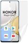 Screenshield HONOR Magic 4 lite 5G fólia na displej - Ochranná fólia