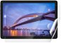 Védőfólia Screenshield IGET Smart L30 FullHD kijelzővédő fólia - Ochranná fólie