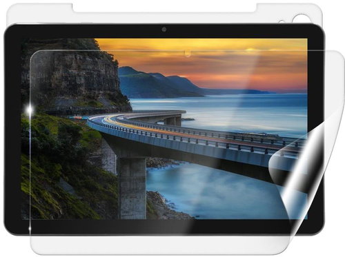 Screenshield IGET Smart W30 védőfólia - Kijelzővédő fólia - Fő fotó
