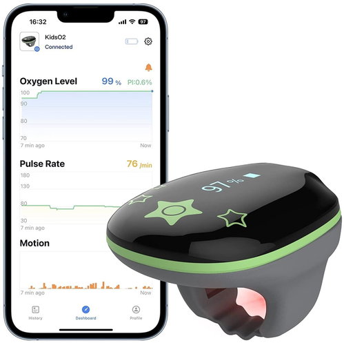 Viatom KidsO2 - Children's oxygen monitor - Diagnostics - Main image