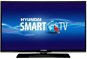 24 &#39;Hyundai HLE 24382 SMART - Television