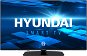 43" Hyundai FLM 43TS349 SMART - Television