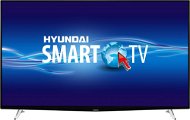 65" Hyundai ULV 65TS300 SMART - Televízor