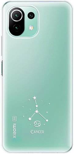 iSaprio clear case - Cancer - Xiaomi Mi 11 Lite - Phone Cover - Main image